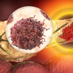 paincriyaz cancer new research