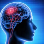 Brain Cancer