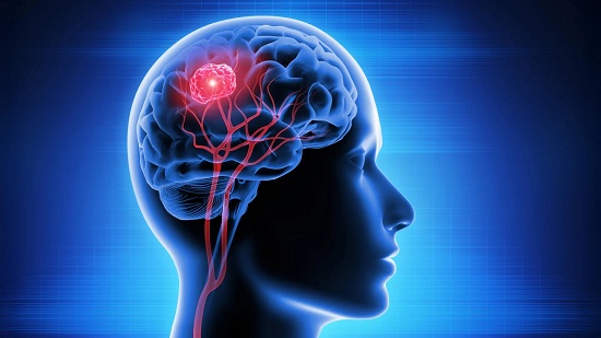 Brain Cancer